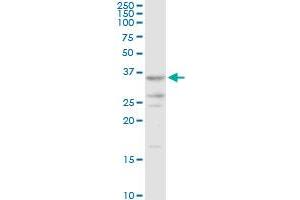 AKR7A2 MaxPab rabbit polyclonal antibody. (AKR7A2 antibody  (AA 1-330))