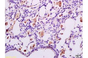 Formalin-fixed and paraffin embedded rat lung tissue labeled with Anti phospho-IFNAR1(Ser535+Ser539) Polyclonal Antibody,Unconjugated (ABIN802353) at 1:200 followed by conjugation to the secondary antibody and DAB staining. (IFNAR1 antibody  (pSer535, pSer538))