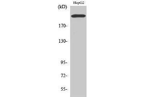 Western Blotting (WB) image for anti-Integrin beta 4 (ITGB4) (Ser636) antibody (ABIN3185206) (Integrin beta 4 antibody  (Ser636))