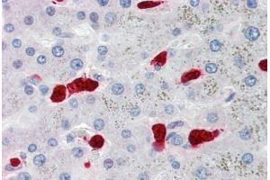 Human Liver, Hepatocytes and Macrophages (formalin-fixed, paraffin-embedded) stained with S100A8 antibody ABIN334264 at 5 ug/ml followed by biotinylated anti-mouse IgG secondary antibody ABIN481714, alkaline phosphatase-streptavidin and chromogen. (S100A8 antibody)