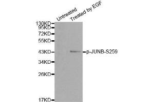 Western blot analysis of extracts from HT29 cells, using Phospho-JUNB-S259 antibody. (JunB antibody  (pSer259))