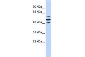 Image no. 1 for anti-HSPB (Heat Shock 27kDa) Associated Protein 1 (HSPBAP1) (AA 180-229) antibody (ABIN6742394) (HSPBAP1 antibody  (AA 180-229))