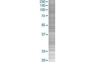 ERAP2 transfected lysate. (LRAP 293T Cell Transient Overexpression Lysate(Denatured))