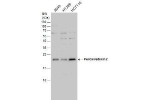 WB Image Peroxiredoxin 2 antibody detects Peroxiredoxin 2 protein by western blot analysis. (Peroxiredoxin 2 antibody)