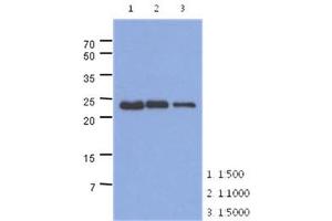 Image no. 1 for anti-Slow Skeletal Troponin I (TNNI1) (AA 1-187), (N-Term) antibody (ABIN1449413) (TNNI1 antibody  (N-Term))
