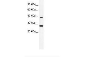 Image no. 2 for anti-Prolactin Regulatory Element Binding (PREB) (AA 140-189) antibody (ABIN6735919) (PREB antibody  (AA 140-189))