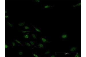 Immunofluorescence of purified MaxPab antibody to MSX2 on HeLa cell.