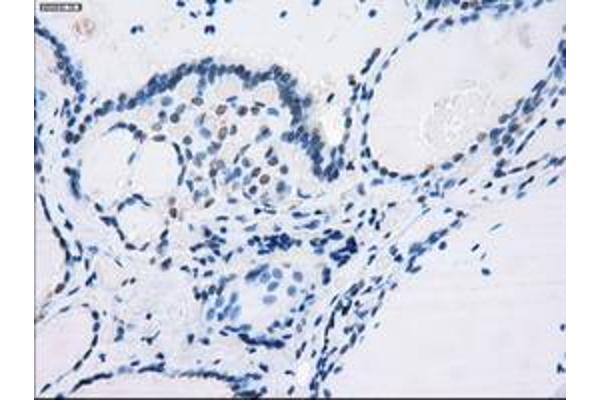 FCGR2A antibody