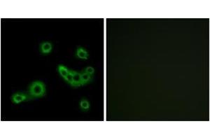 Immunofluorescence analysis of MCF7 cells, using PEVR2 Antibody. (PEVR2 (AA 235-284) antibody)