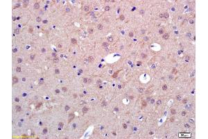 Formalin-fixed and paraffin embedded rat brain labeled with Anti-PAPOA Polyclonal Antibody, Unconjugated (ABIN1714857) at 1:200 followed by conjugation to the secondary antibody and DAB staining. (PAPOLA antibody  (AA 601-700))