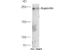Mouse heart lysates probed with Rabbit Anti-Supervillin Polyclonal Antibody, Unconjugated (ABIN1714235) at 1:300 overnight at 4 °C. (Supervillin antibody  (AA 51-150))