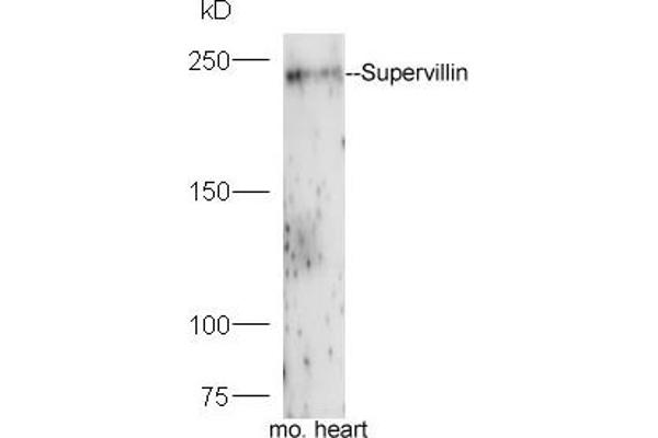 Supervillin 抗体  (AA 51-150)
