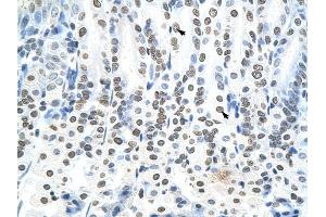 RNF6 antibody was used for immunohistochemistry at a concentration of 4-8 ug/ml to stain Epithelial cells of intestinal villus (arrows) in Mouse Intestine. (RNF6 antibody  (N-Term))