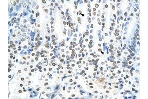 RNF6 antibody was used for immunohistochemistry at a concentration of 4-8 ug/ml to stain Epithelial cells of intestinal villus (arrows) in Mouse Intestine.