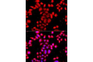 Immunofluorescence analysis of A549 cells using OSGEPL1 antibody (ABIN5974954).