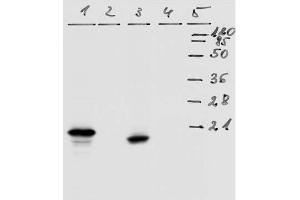 Western-Blot analysis of HPV-18 E7 protein. (HPV18 E7 antibody  (AA 36-70))