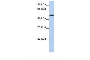 Image no. 1 for anti-Pleckstrin Homology-Like Domain, Family A, Member 1 (PHLDA1) (AA 218-267) antibody (ABIN6739002) (PHLDA1 antibody  (AA 218-267))