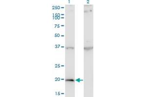 Western Blot analysis of IFNA1 expression in transfected 293T cell line by IFNA1 monoclonal antibody (M07), clone 3C6. (IFNA1 antibody  (AA 24-133))