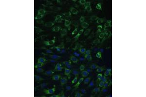 Immunofluorescence (IF) image for anti-Eukaryotic Translation Elongation Factor 1 gamma (EEF1G) (AA 168-437) antibody (ABIN6139951)