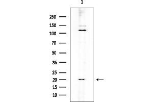 anti-Cyclin-Dependent Kinase Inhibitor 3 (CDKN3) (Internal Region) antibody