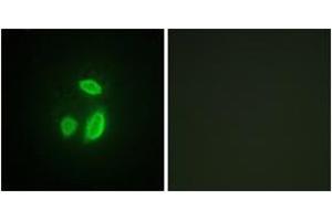 Immunofluorescence (IF) image for anti-Extra Spindle Poles Like 1 (ESPL1) (AA 767-816) antibody (ABIN2879105)