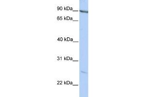 WB Suggested Anti-MARCH2 Antibody Titration:  0.