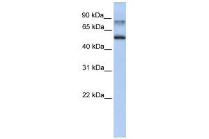 Epsin 1 antibody used at 1 ug/ml to detect target protein. (Epsin 1 antibody  (C-Term))