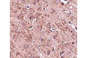 Immunohistochemistry (IHC) image for anti-GLE1 RNA Export Mediator (GLE1) (Middle Region) antibody (ABIN1030940) (GLE1 antibody  (Middle Region))