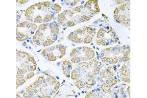 Immunohistochemistry of paraffin-embedded Human stomach using TNFRSF10A Polyclonal Antibody at dilution of 1:100 (40x lens). (TNFRSF10A antibody)