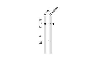 All lanes : Anti-Arylsulfatase D Antibody at 1:1000 dilution Lane 1: K562 whole cell lysates Lane 2: human kidney lysates Lysates/proteins at 20 μg per lane.