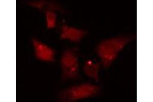 ABIN6277056 staining  SW626 cells by IF/ICC. (CTNNB1 antibody  (C-Term))