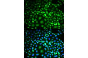 Immunofluorescence analysis of MCF-7 cells using RUVBL2 antibody. (RUVBL2 antibody  (AA 1-463))