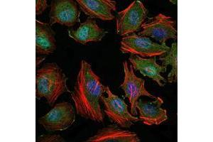 Immunofluorescence (IF) image for anti-Mitogen-Activated Protein Kinase Kinase Kinase 5 (MAP3K5) antibody (ABIN969273)