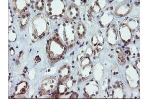 Image no. 2 for anti-Dual Specificity Phosphatase and Pro Isomerase Domain Containing 1 (DUPD1) antibody (ABIN1497927) (DUPD1 antibody)