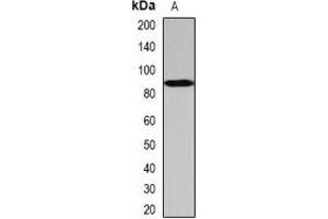 Western blot analysis of SCYL1 expression in Hela (A) whole cell lysates. (SCYL1 antibody)