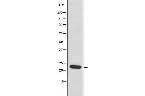 MRPL22 antibody  (Internal Region)