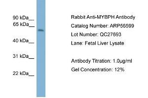 WB Suggested Anti-MYBPH  Antibody Titration: 0. (MYBPH antibody  (Middle Region))