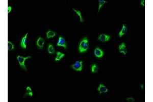 ATP13A2 antibody  (AA 582-736)