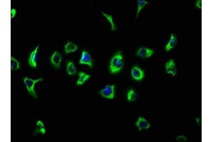 Immunofluorescence staining of A549 cells with ABIN7147051 at 1:133, counter-stained with DAPI. (ATP13A2 antibody  (AA 582-736))