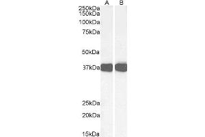 ABIN190828 (0. (Liver Arginase antibody  (C-Term))