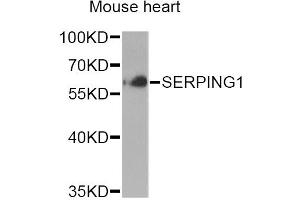 Western blot analysis of extracts of mouse heart, using SERPING1 Antibody (ABIN6290125) at 1:1000 dilution. (SERPING1 antibody)