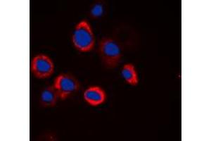 Immunofluorescent analysis of EGFR staining in HeLa cells. (EGFR antibody  (Center))