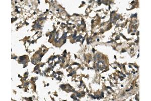 IHC analysis of IL3RA using anti-IL3RA antibody (ABIN7599742).