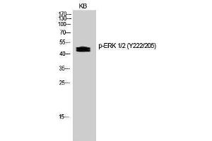 Western Blotting (WB) image for anti-Mitogen-Activated Protein Kinase 1/3 (MAPK1/3) (pTyr205), (pTyr222) antibody (ABIN3182386) (ERK1/2 antibody  (pTyr205, pTyr222))