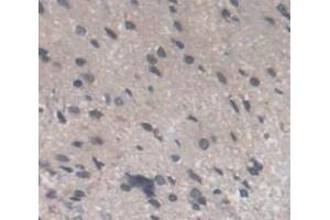 IHC-P analysis of Kidney tissue, with DAB staining. (Recoverin antibody  (AA 2-200))