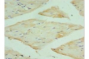 Immunohistochemistry of paraffin-embedded human skeletal muscle tissue using ABIN7167692 at dilution of 1:100 (RPA4 antibody  (AA 1-230))