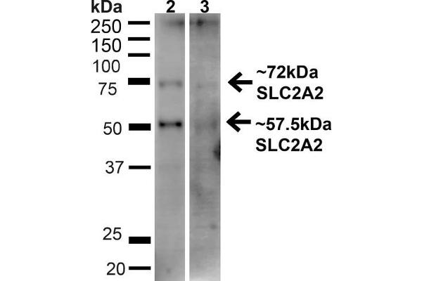 SLC2A2 Antikörper  (C-Term)
