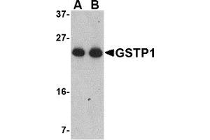 Western Blotting (WB) image for anti-Glutathione S-Transferase pi 1 (GSTP1) (Middle Region) antibody (ABIN1030946) (GSTP1 antibody  (Middle Region))