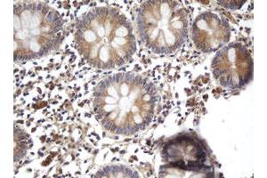 Image no. 2 for anti-ADP-Ribosylation Factor-Like 2 Binding Protein (ARL2BP) antibody (ABIN1496716) (ARL2BP antibody)