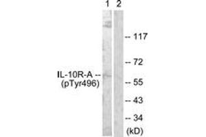 Western blot analysis of extracts from HuvEc cells, using IL-10R alpha (Phospho-Tyr496) Antibody. (IL-10RA antibody  (pTyr496))